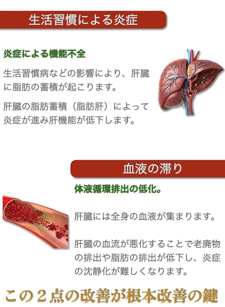生活習慣や食生活の影響によって脂肪が蓄積し炎症が起こります。
肝臓には全身の血液が集まります。
肝臓の血流が悪化することで老廃物や脂肪の代謝が低下し、炎症の沈静化が難しくなります。
この炎症と血流の改善が漢方のセオリーです。