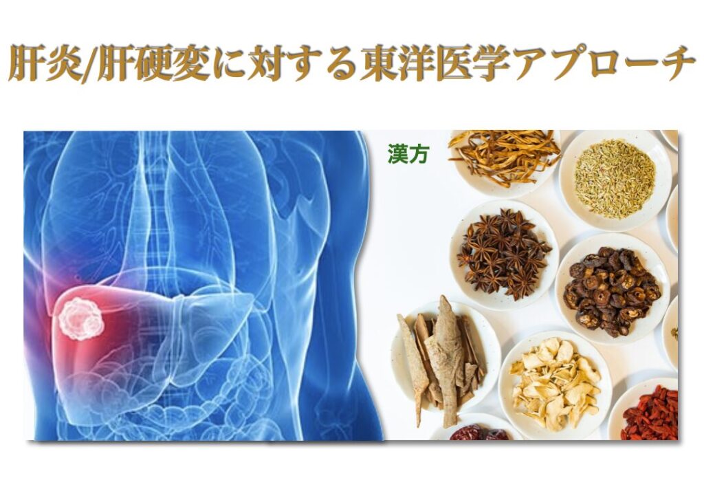 肝炎/肝硬変などの肝機能障害に対する漢方アプローチ
